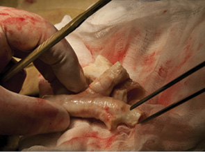 Рис. 5. Аллотрансплантация деиммунизированной трахеи с бронхами. Подготовка аллотрансплантата к пересадке