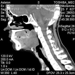 Рис. 1. Спіральна КТ голови та шиї хворої Р.