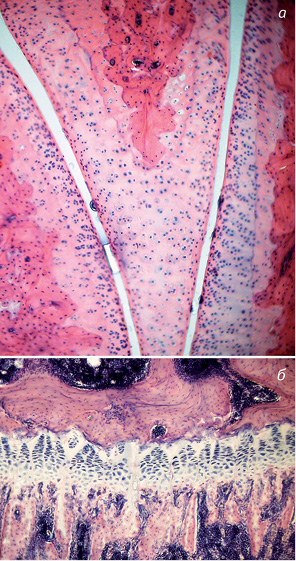 Рис. 4. Щури інтактної групи. Гематоксилін-еозин. Зб. 80: а) суглобові поверхні стегнової, великогомілкової кістки колінного суглоба та латеральний меніск; б) наростковий хрящ стегнової кістки колінного суглоба з чіткими колонками хондроцитів та характерною зональністю клітин у колонках