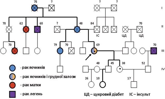 Рис. 3. Родовід пробада Б. (мутація BRCA1 185delAG у пацієнтки та її дочки)