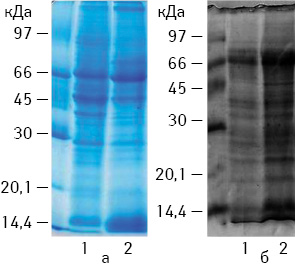 Рис. 1. Електрофореграма поверхневих білків клітин (а) РЕ та (б) КЛЛ (1 — до ГТ та 2 — після ГТ)