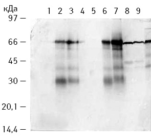 Рис. 3. Імуноблот-тест рівня БТШ 70 кДа в екстрактах пухлин та вакцинах, виготовлених на їх основі: 1 — БМ 70 кДа B. subtilis B-7025; 2 — вакцина КЛЛ + БМ 70 кДа; 3 — вакцина КЛЛ (ГТ) + БМ 70 кДа; 4 — вакцина КЛЛ + БМ 18,5 кДа; 5 — вакцина КЛЛ (ГТ) + БМ 18,5 кДа; 6 — ЕДТА-екстракт КЛЛ; 7 — ЕДТА-екстракт КЛЛ (ГТ); 8 — ЕДТА-екстракт РЕ (ГТ); 9 — ЕДТА-екстракт РЕ