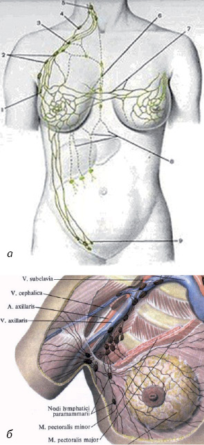 Рис. 1. ГЗ. а — шляхи відтоку лімфи від ГЗ; б — найчастіші локалізації СЛВ при РГЗ