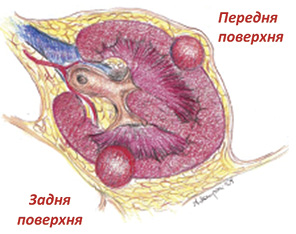 Рис. 1. Поділ на передню і задню поверхню нирки