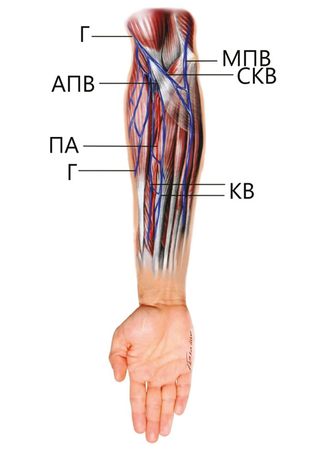 Рис. 11. Схематичне зображення поверхневої та глибокої венозних систем передпліччя: Г — головна вена; КВ — комітантні вени променевої артерії; ПА — променева артерія; АПВ — антекубітальна перфорантна вена; СКВ — серединна кубітальна вена; МПВ — медіальна підшкірна вена